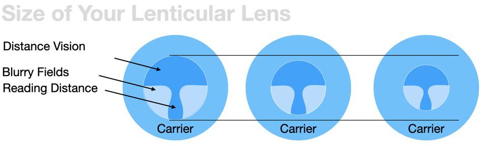 lenticular progressive lenses