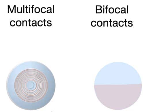 Single Vision Vs Bifocal Lenses Explained With Examples 4381