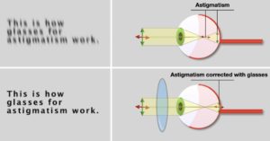 Example Of Astigmatism Corrected With Glasses 300x157 