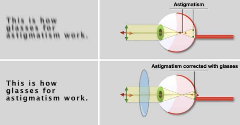 how-do-lenses-for-astigmatism-work