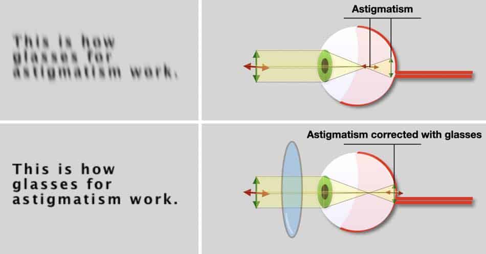 will glasses help astigmatism