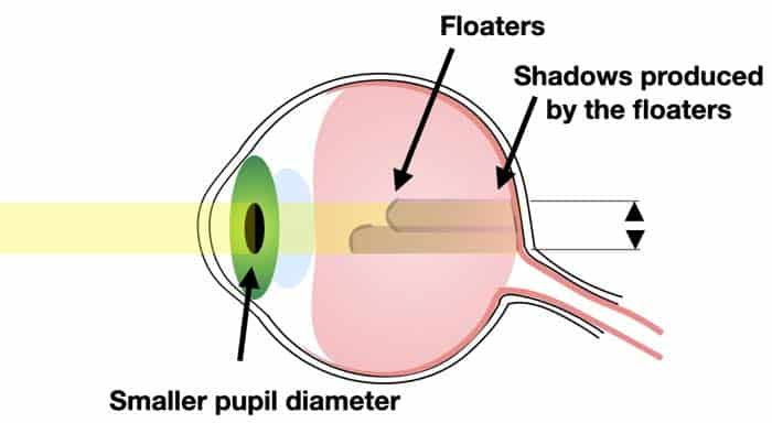 best sunglasses for eye floaters