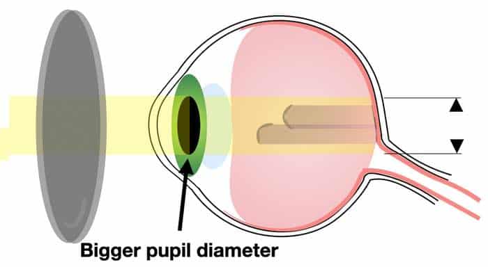 best tinted glasses for floaters