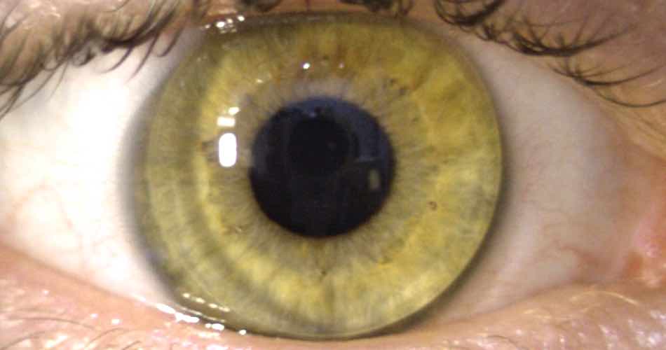 How Contact Lenses Are Made?