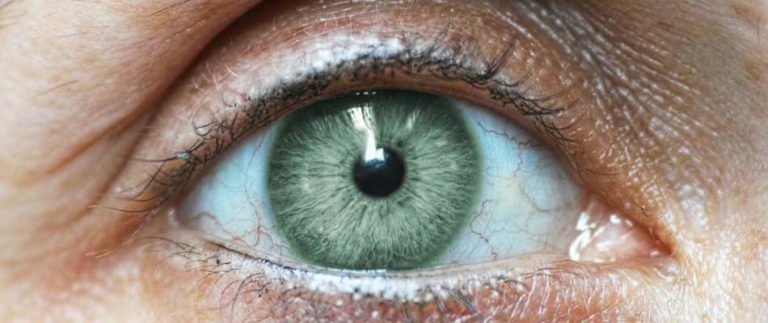 Blurred Vision After Cataract Surgery Possible Causes